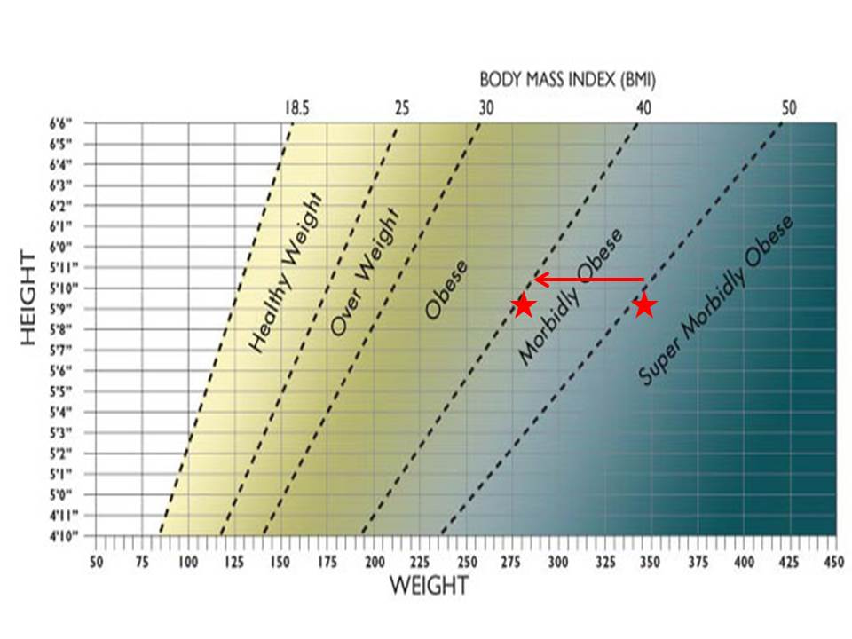 Overweight Obese Morbidly Obese Chart